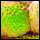 Legionnaires' Disease
