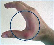 Figure 7 "C-shape" hand posture.
